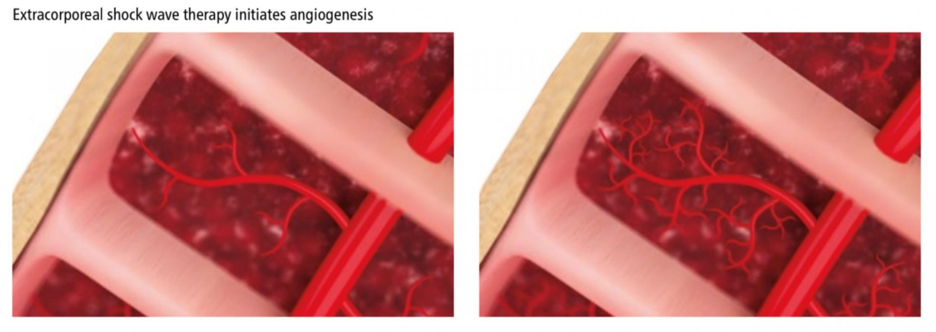 blood cells